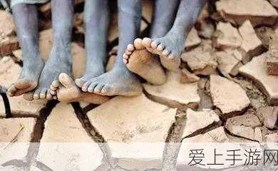 手游医疗新突破，AI大模型仅凭照片识别近视，助力基层医疗革新