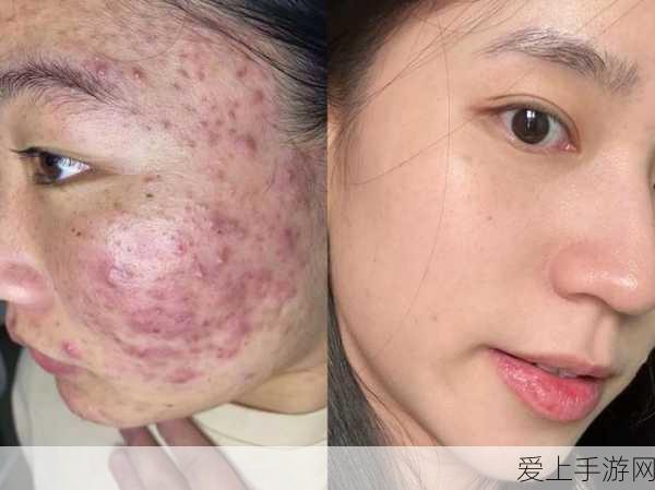 云顶之弈手游服务端错误解决方案，助你重返棋盘，畅享竞技乐趣